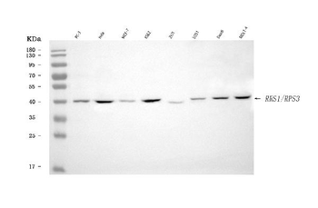 Anti-RRS1 Antibody