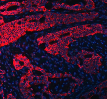 Anti-RPL36 Antibody