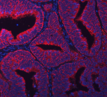 Anti-RPL36 Antibody