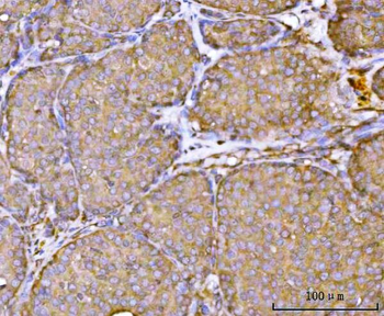 Anti-RPL36 Antibody
