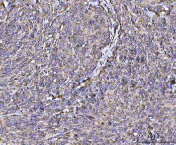 Anti-RPL36 Antibody