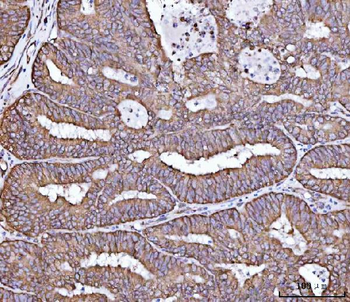 Anti-RPL36 Antibody