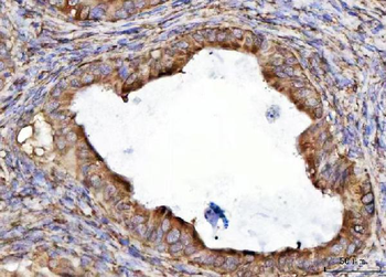 Anti-RPL36 Antibody