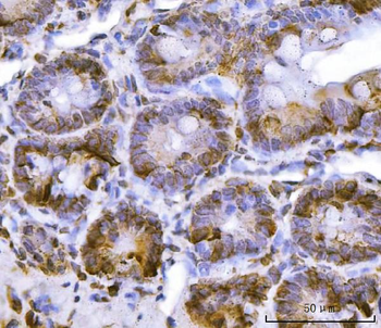 Anti-RPL36 Antibody