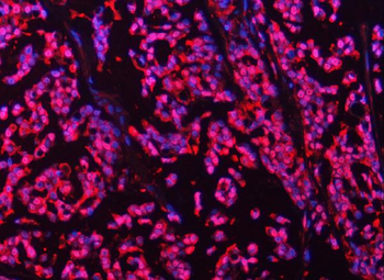 Anti-PSMB4 Antibody