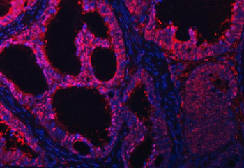 Anti-PSMB4 Antibody