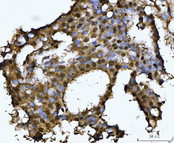 Anti-PSMB4 Antibody