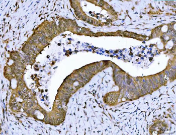 Anti-PSMB4 Antibody