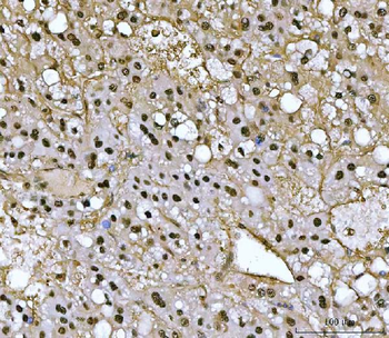 Anti-PSMB4 Antibody