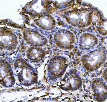 Anti-PSMB4 Antibody