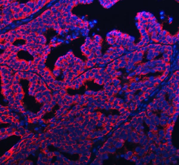Anti-APP-1/PABPC4 Antibody
