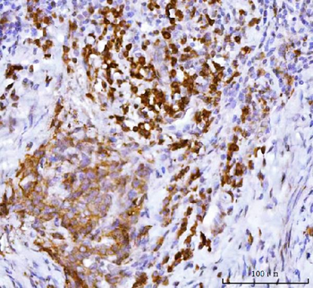 Anti-APP-1/PABPC4 Antibody