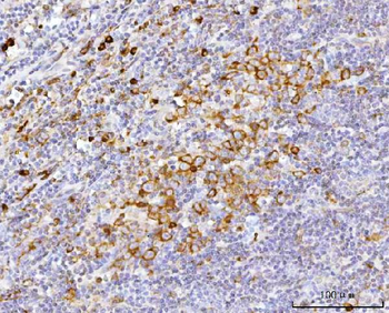 Anti-APP-1/PABPC4 Antibody