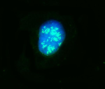 Anti-NOP58 Antibody