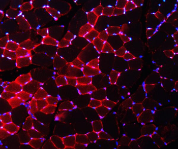Anti-Nedd4 Antibody