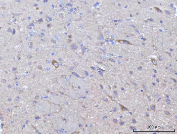Anti-Nedd4 Antibody