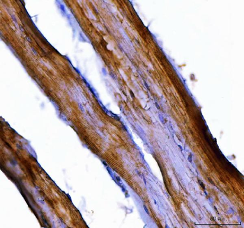 Anti-Nedd4 Antibody