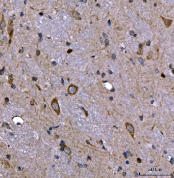 Anti-Nedd4 Antibody