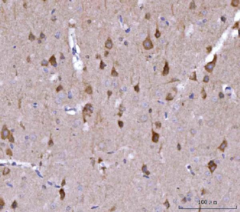 Anti-Nedd4 Antibody