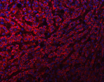 Anti-NDUFS8 Antibody