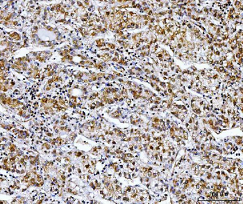 Anti-NDUFS8 Antibody