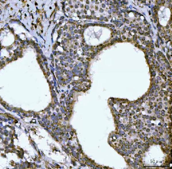 Anti-NDUFS6 Antibody