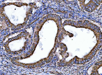 Anti-NDUFS6 Antibody