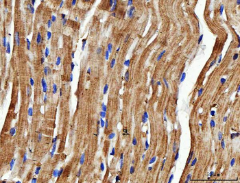 Anti-NDUFS6 Antibody