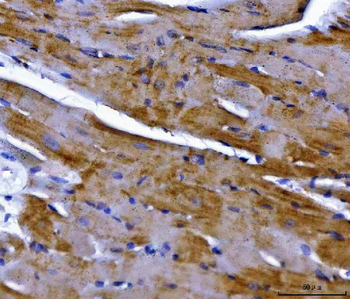 Anti-NDUFS2 Antibody