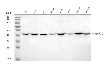 Anti-NDUFS2 Antibody