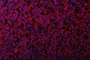 Anti-NDUFS2 Antibody