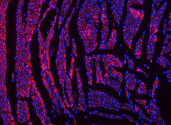 Anti-NDUFS2 Antibody