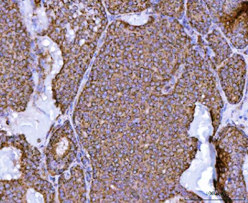 Anti-NDUFS2 Antibody