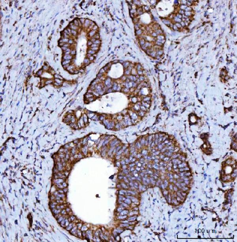 Anti-NDUFS2 Antibody