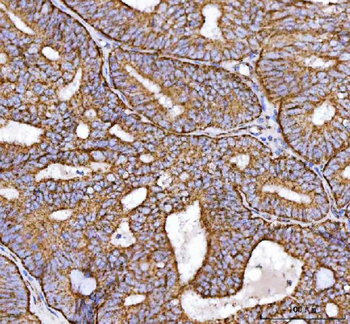 Anti-NDUFS2 Antibody