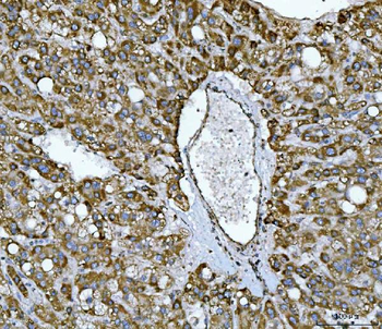 Anti-NDUFS2 Antibody