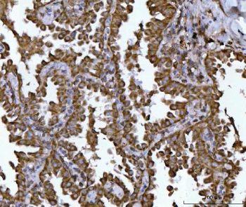 Anti-NDUFS2 Antibody