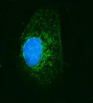 Anti-MRPS22 Antibody