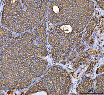 Anti-MRPS22 Antibody