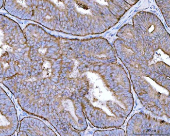 Anti-MRPS22 Antibody