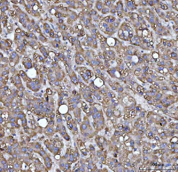 Anti-MRPS22 Antibody