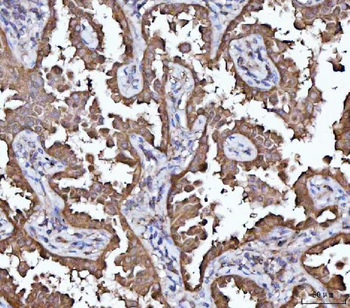 Anti-MRPS22 Antibody