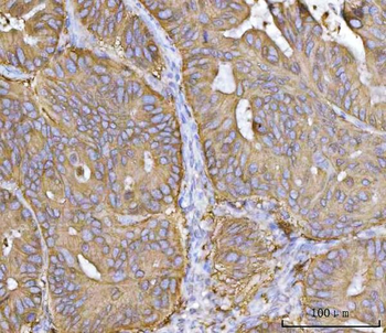 Anti-MRPS22 Antibody