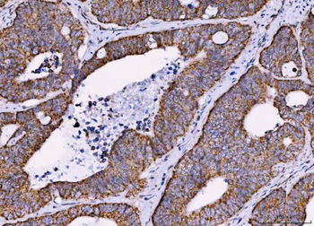 Anti-MRPS18B Antibody