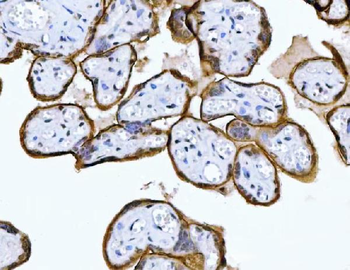 Anti-MRPS18B Antibody