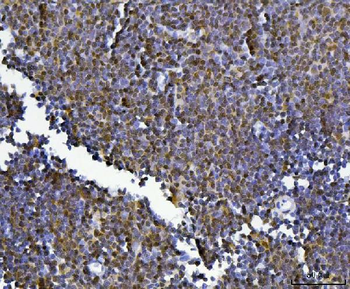 Anti-KLF13 Antibody