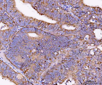 Anti-Eg5/KIF11 Antibody