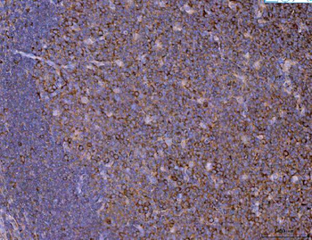 Anti-Eg5/KIF11 Antibody