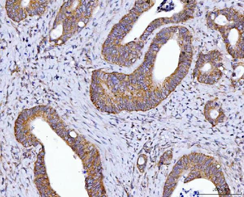 Anti-HAX1 Antibody