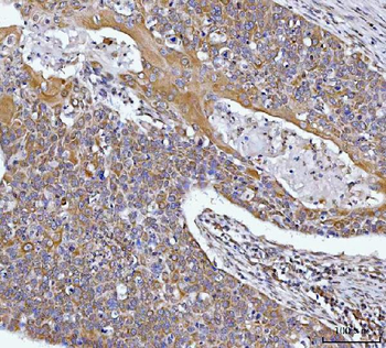 Anti-HAX1 Antibody